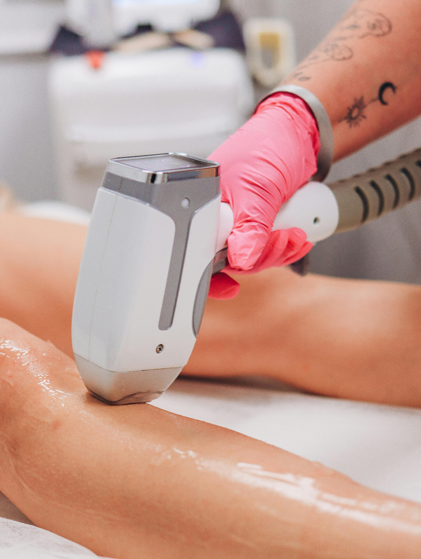 Why Autumn Is the Best Time to Start Laser Hair Removal